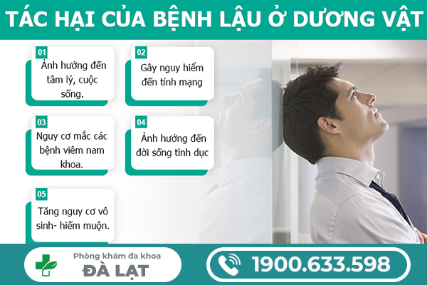 Hình ảnh minh họa